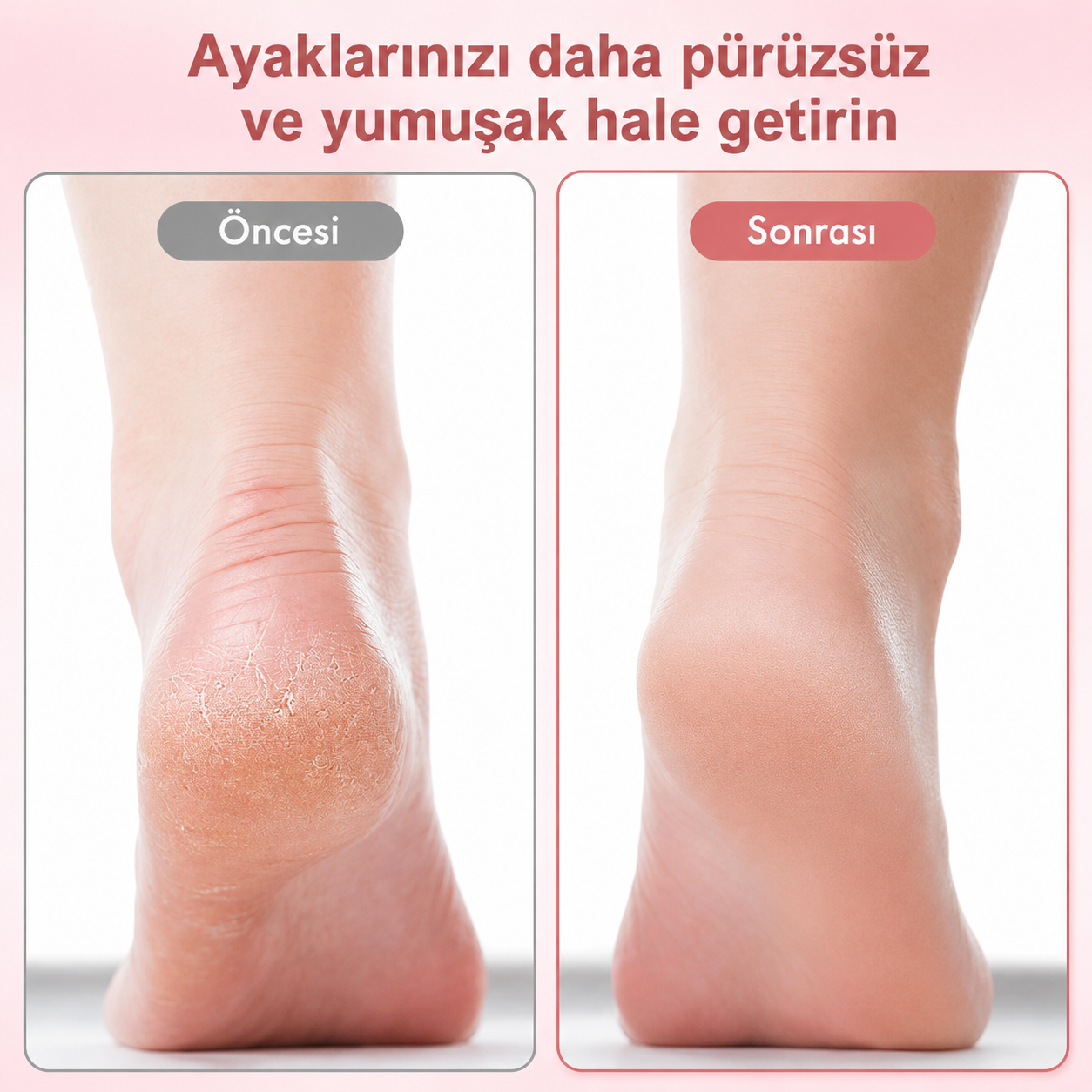 Şarjlı Topuk Törpüsü